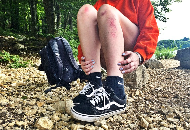 west-nile-virus-mosquitoes-insect-bites-travel-1